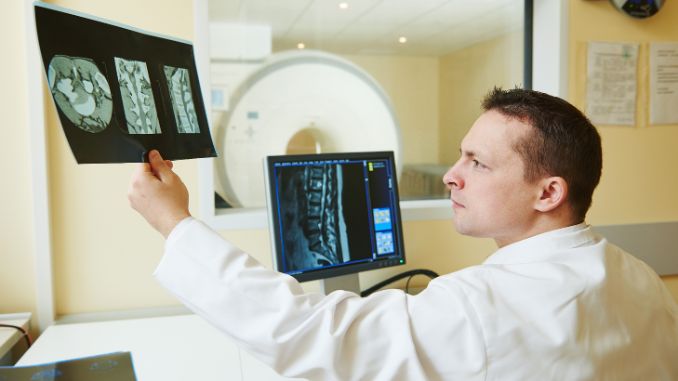 Imaging Tests-Scoliosis Vs Multiple Sclerosis