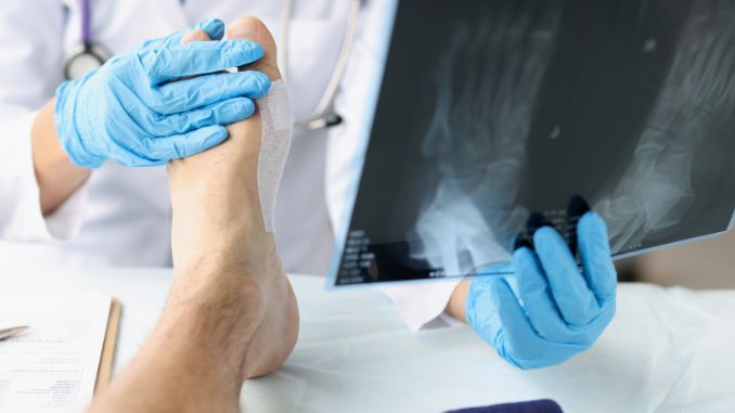 When to Seek Medical Attention and Physical Examination- midfoot sprain
