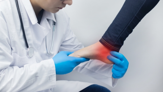 Diagnosing Ankle Injuries