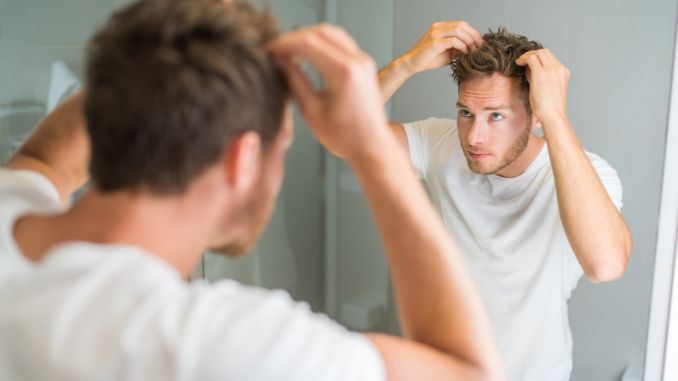 hair-loss-man