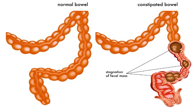 Medical illustration of the symptoms